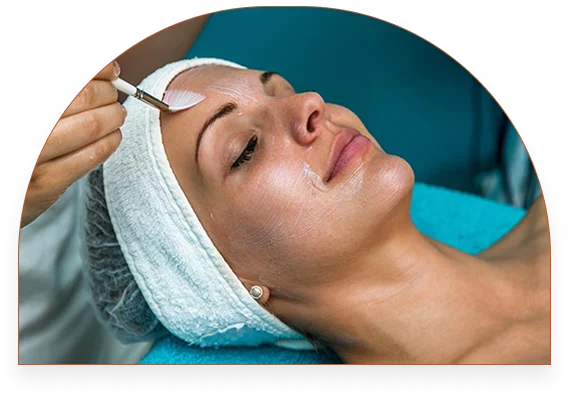 Chemical Peel results at SK'N THEORY