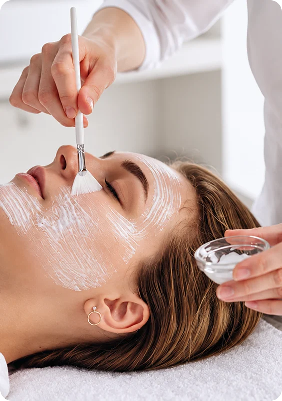 Chemical Peel at SK'N THEORY