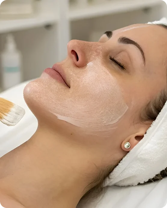 Chemical Peel consultation at SK'N THEORY