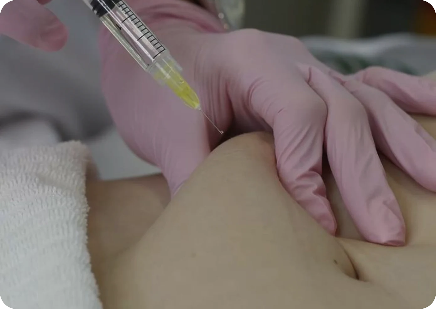 Fat Dissolving Injections at SK'N THEORY, Karachi