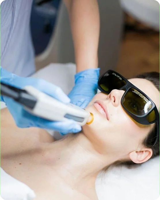 Laser Hair Removal consultation at SK'N THEORY