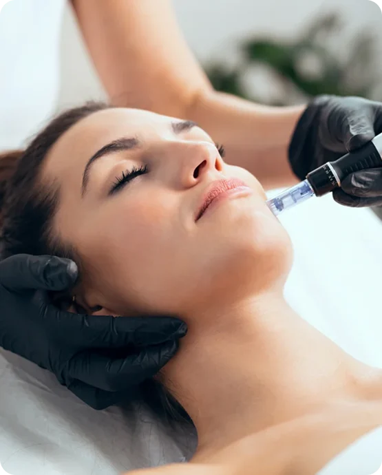 Microneedling consultation at SK'N THEORY