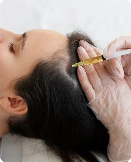 PRP Therapy consultation at SK'N THEORY