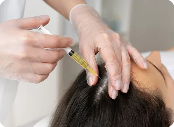 PRP Therapy at SK'N THEORY clinic in Karachi