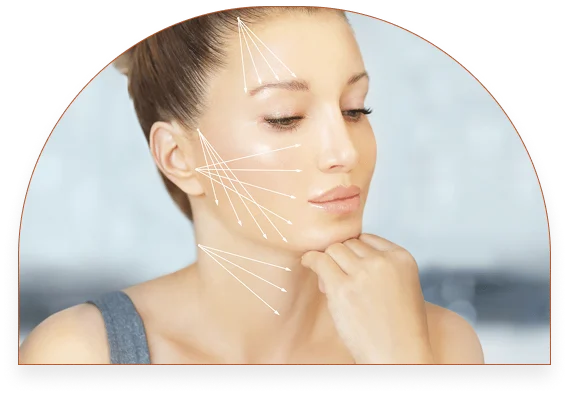 Thread Lifting results at SK'N THEORY