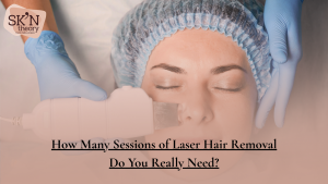 How Many Sessions of Laser Hair Removal Do You Really Need?