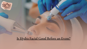 Is HydraFacial Good Before an Event? What You Need to Know