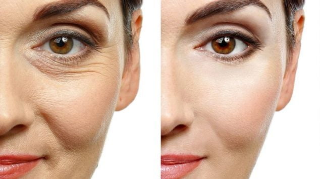 Botox Treatment: What Every First-Timer Should Know