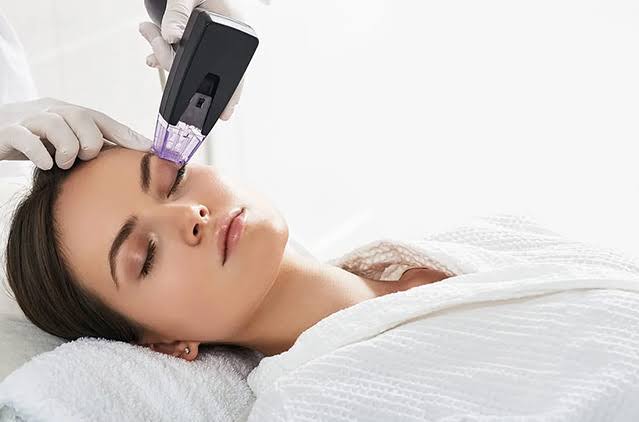 Common Questions People Ask About Morpheus8 Before Treatment